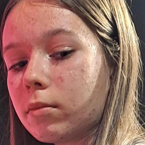 Zdjęcie przed leczeniem