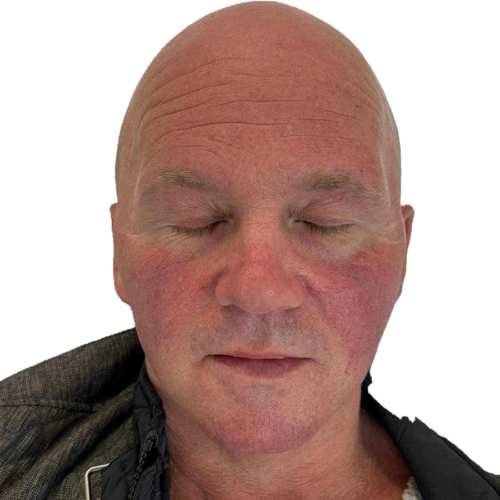 Zdjęcie przed leczeniem